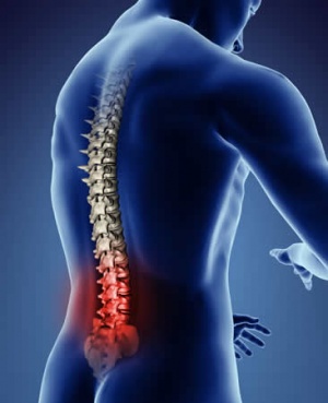 Lumbar- Spondylosis
