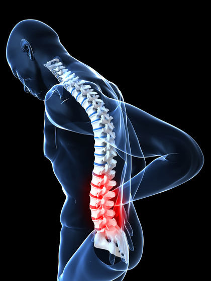 Prolapsed Disc