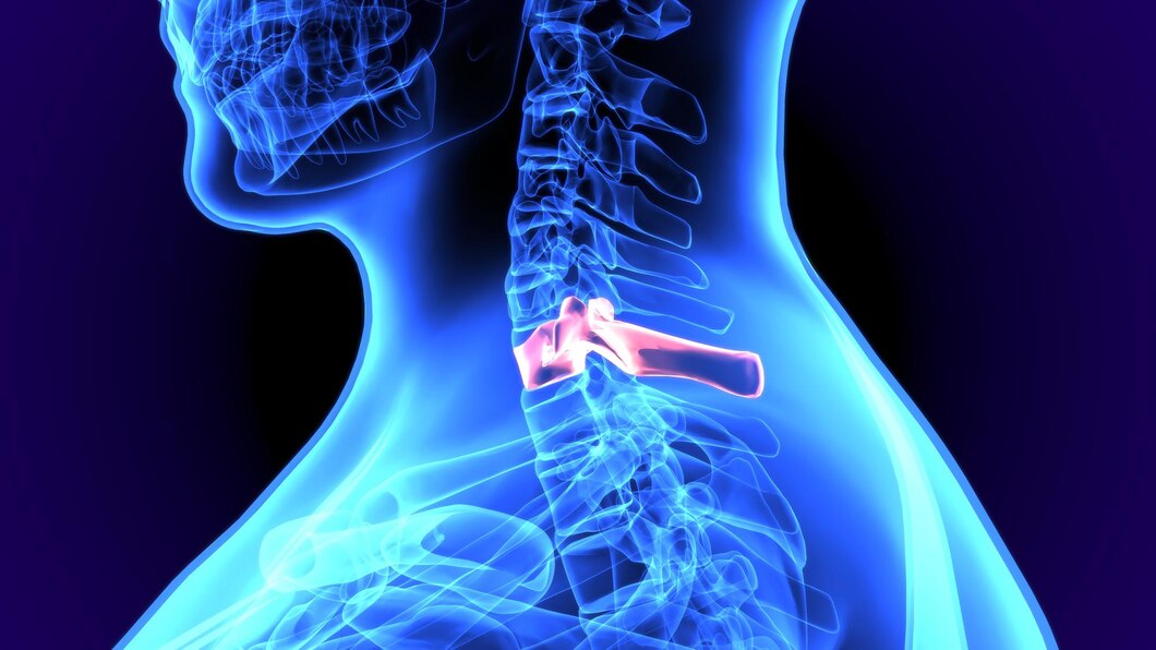 Spondylolisthesis